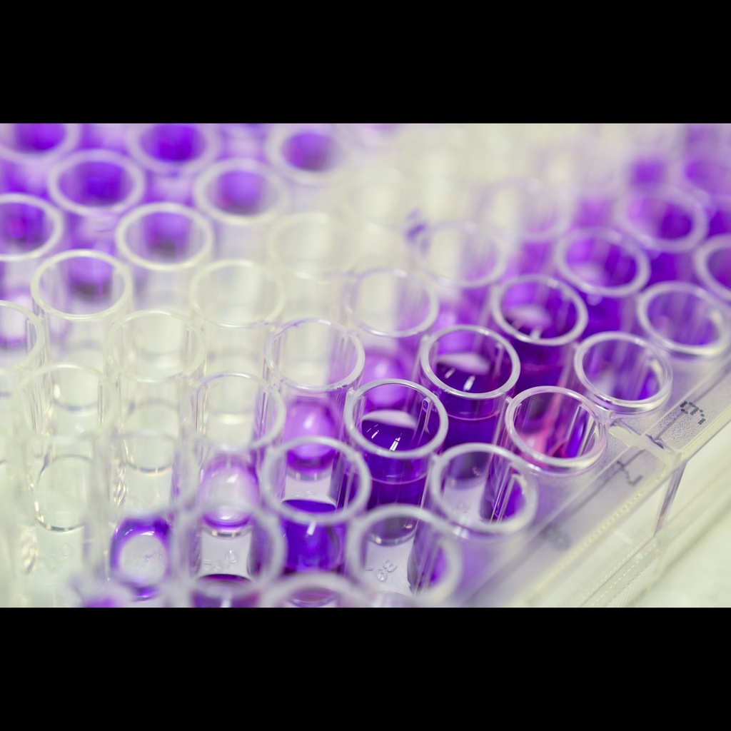 FGF1 elisa kit :: Human Fibroblast Growth Factor 1, Acidic  FGF1  ELISA Kit size: 96